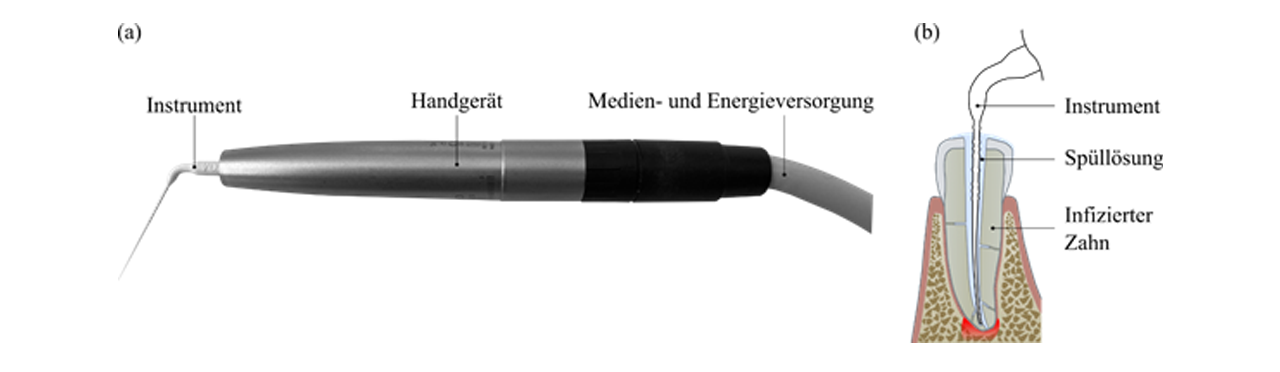 Forschungsgrafik endodontisches Instrument  © Dr.-Ing. Michael Kucher HTWK Leipzig